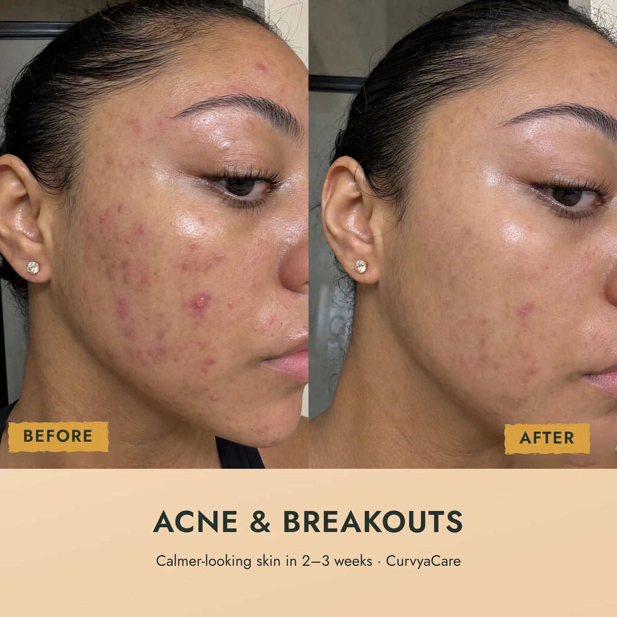 Dark Spots Out Bar™