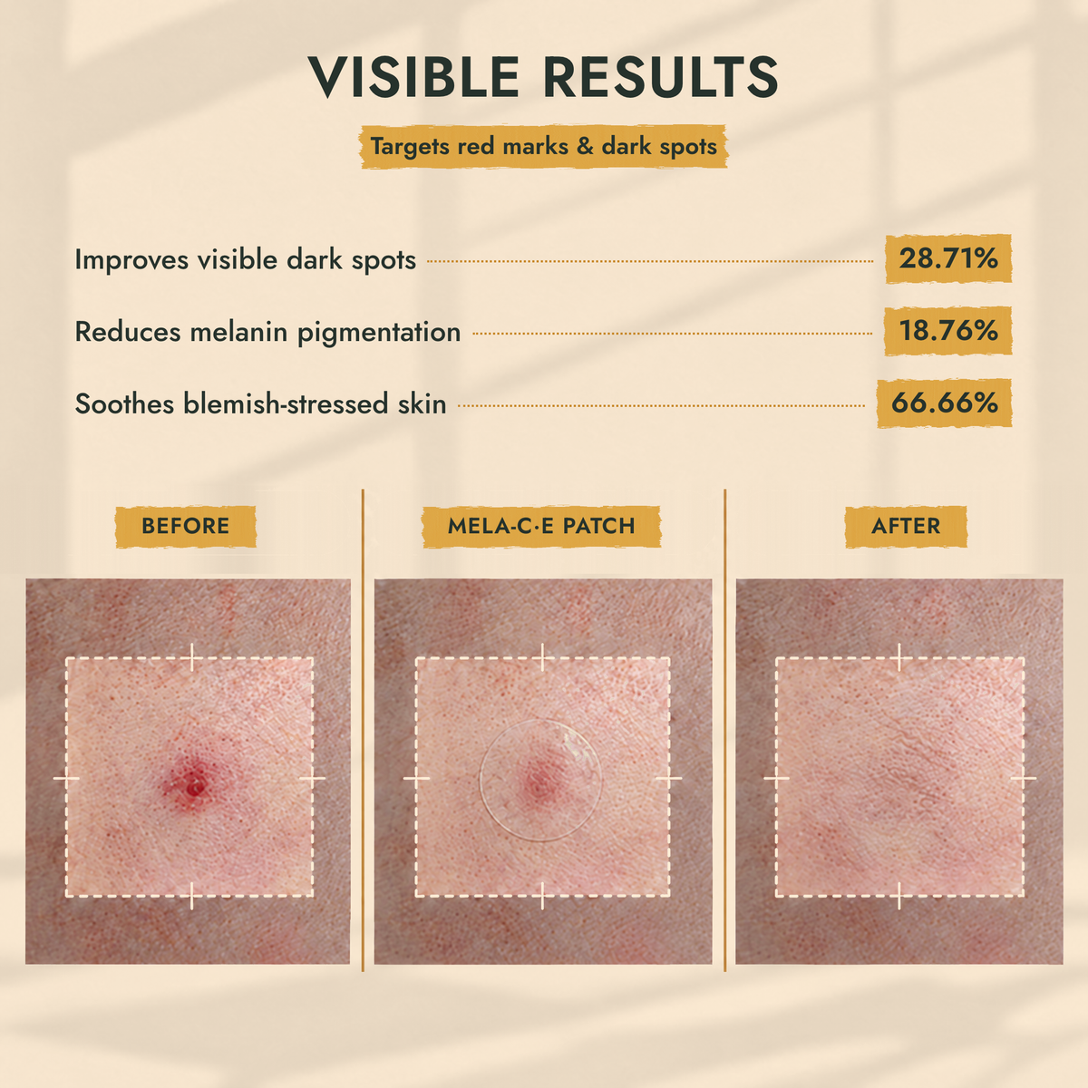 Before and after with the MELA-C·E patch on a red mark