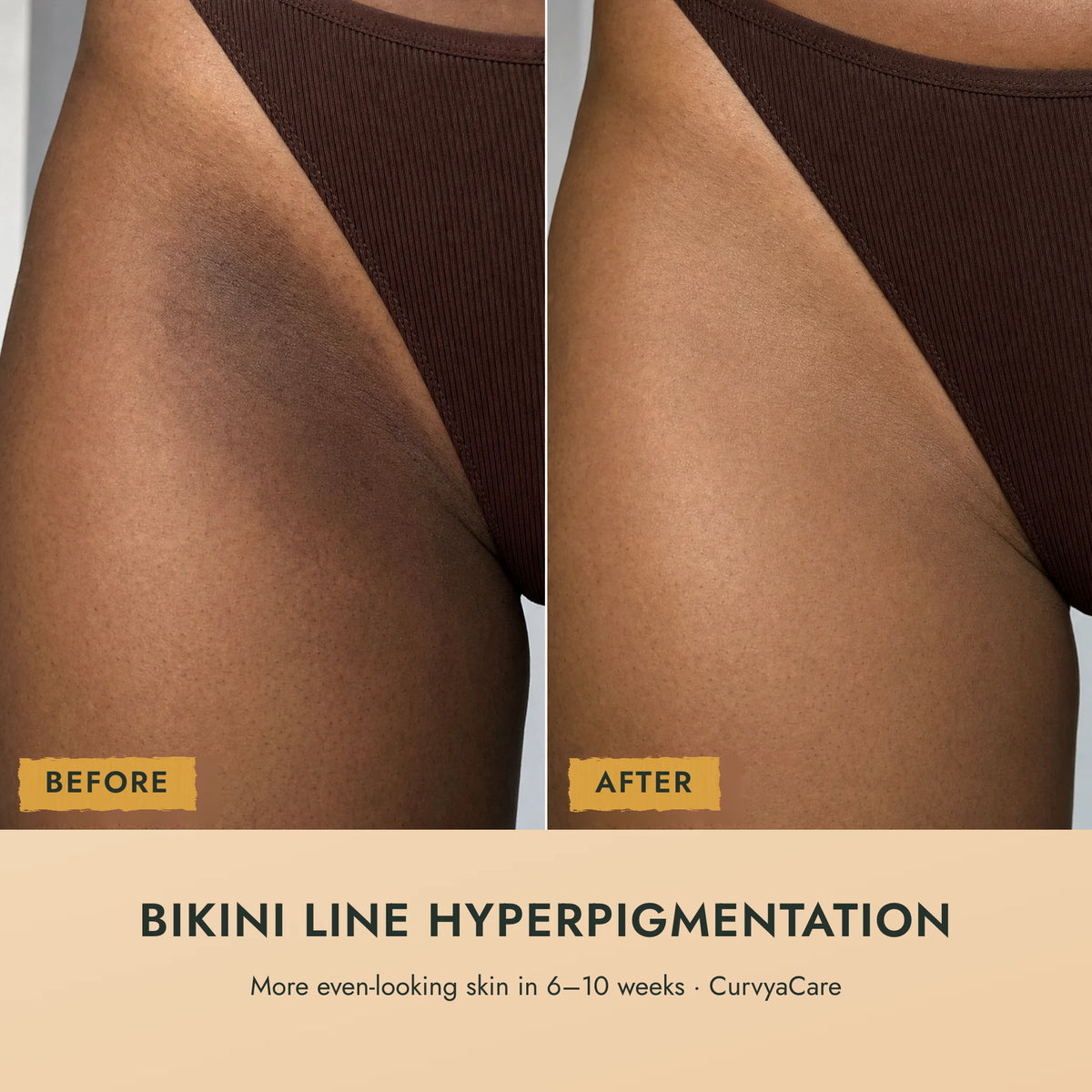 Dark Spots Out Bar™
