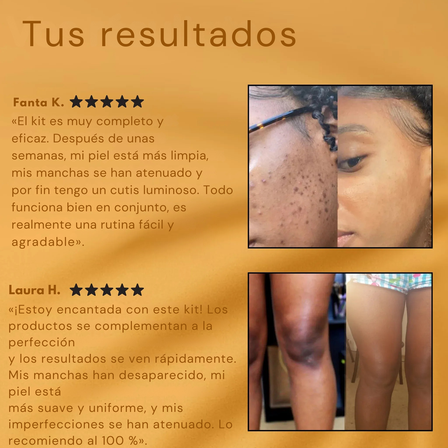Pack Curvya – Ritual Éclat Intenso Rostro y Cuerpo