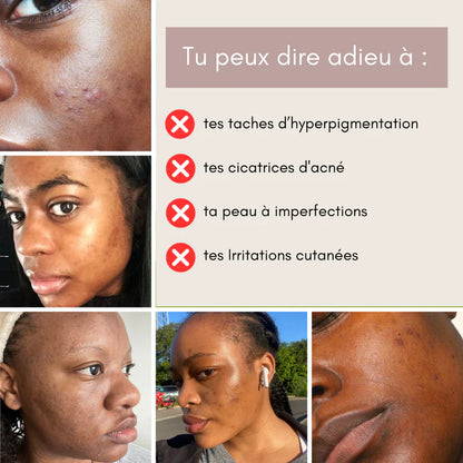 Discos Limpiadores 3 en 1 con Cúrcuma