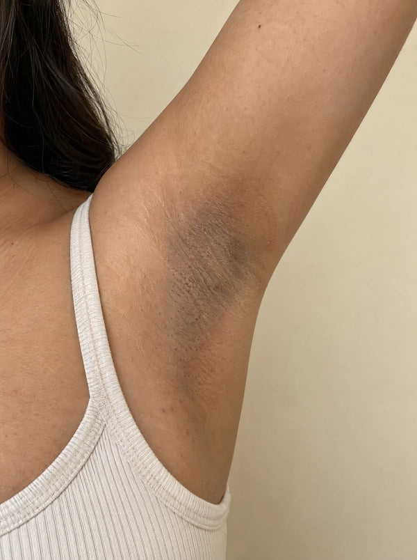 Underarms