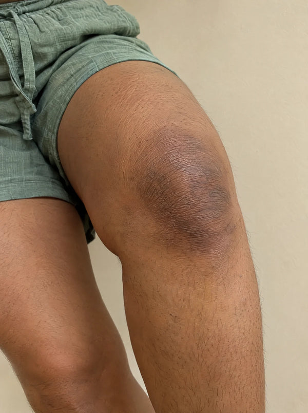 Knees & elbows